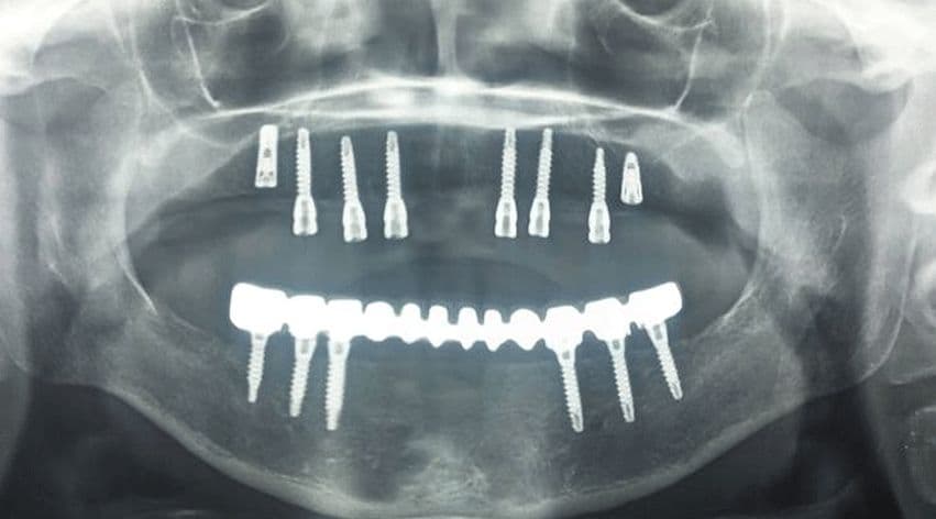 Dr. Shouket Dental Clinic cover