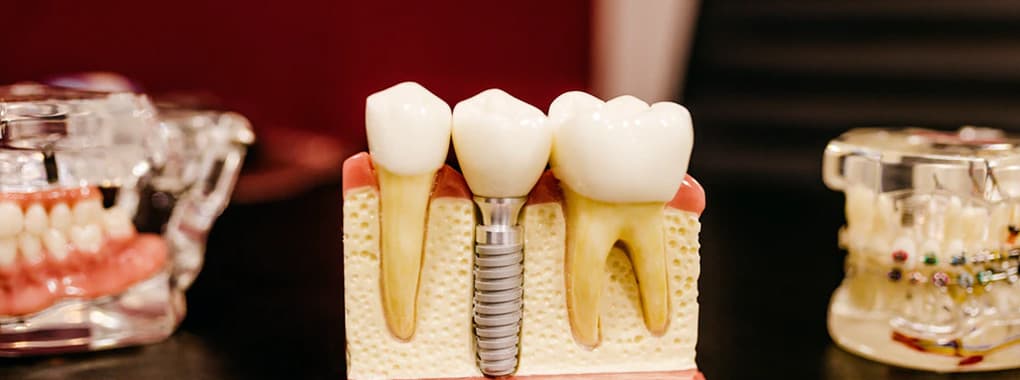 City Dental Care Multan cover