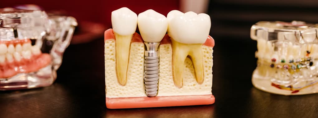 My Dentist Gujrat cover