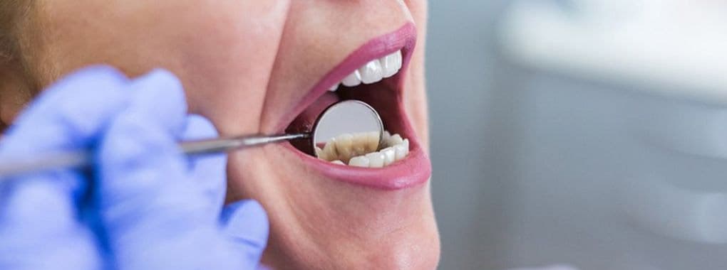 Nafees Dental Care & Implant Centre cover