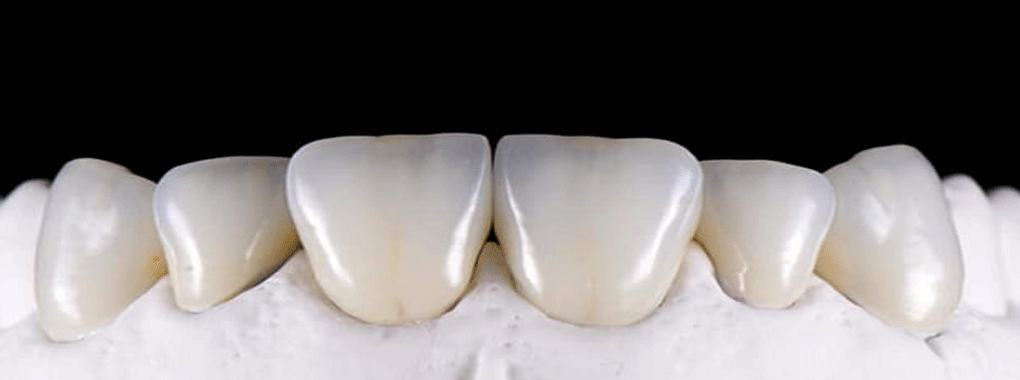Pure Smiles Dental cover